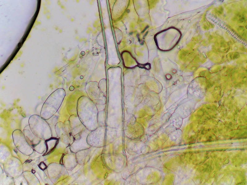 Conidia of powdery mint mildew caused by fungus <B>Neoerysiphe galeopsidis</B> under microscope, from clasping henbit (henbit deadnettle, Lamium amplexicaule) collected in Bee Creek Park. College Station, Texas, March 25, 2022