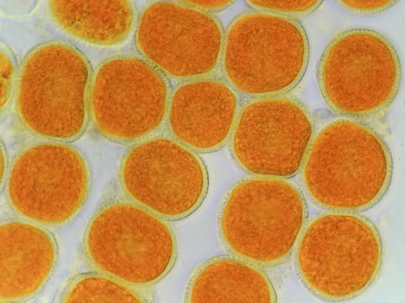 Orange aeciospores of blackberry rust fungus <B>Gymnoconia nitens</B> from Lick Creek Park. College Station, Texas, March 14, 2022